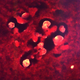 The histopathologic characteristics associated with a case of primary amebic meningoencephalitis due to Naegleria fowleri parasites.